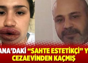 “Sahte estetikçi” yine cezaevinden kaçmış
