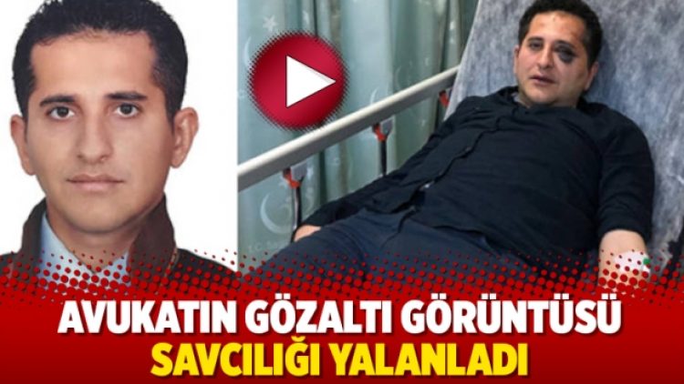 Avukatın gözaltı görüntüsü savcılığı yalanladı