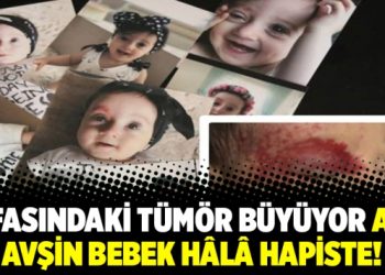 Kafasındaki tümör büyüyor ama Avşin bebek hâlâ hapiste!