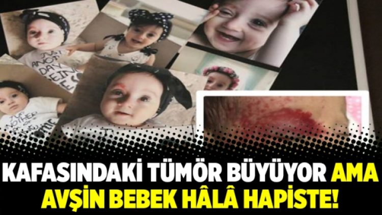 Kafasındaki tümör büyüyor ama Avşin bebek hâlâ hapiste!