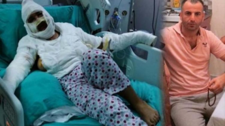 Cezaevinden izinli çıktı: Önce bıçakladı ardından kızgın yağ ile yaktı