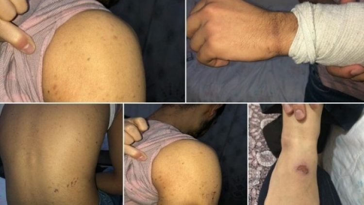 Ev aramalarında işkence vakaları artıyor
