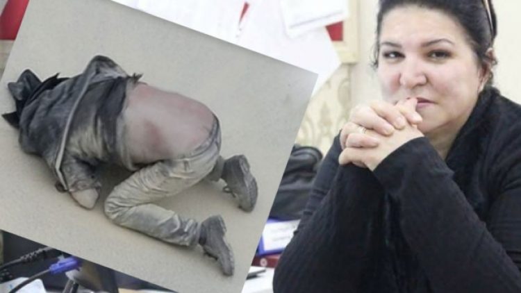 Kendini yakan babaya AKP’liden “ucuz siyasi manevra” paylaşımı tepki çekti