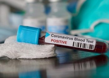 Parası olana ‘özel’ korona virüs testi: Fiyatı 1.250 TL!