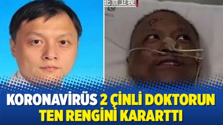 Koronavirüs 2 Çinli doktorun ten rengini kararttı