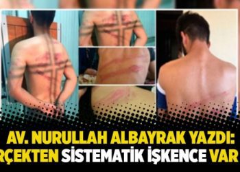 Av. Nurullah Albayrak yazdı: Gerçekten sistematik işkence var mı?