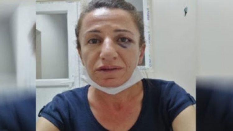 DTK operasyonunda gözaltına alınan siyasetçiye işkence