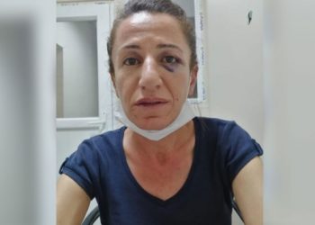 İşkenceye maruz bırakılan Rojbin Çetin tutuklandı