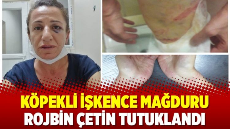 Köpekli işkence mağduru Rojbin Çetin tutuklandı