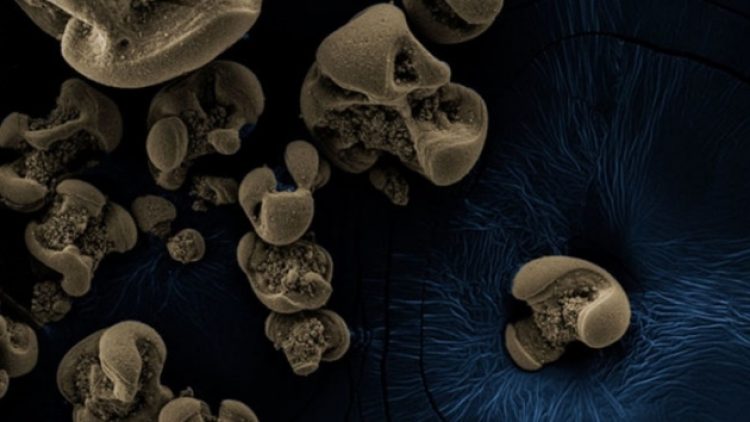 Metal yiyen bakteri bulundu!