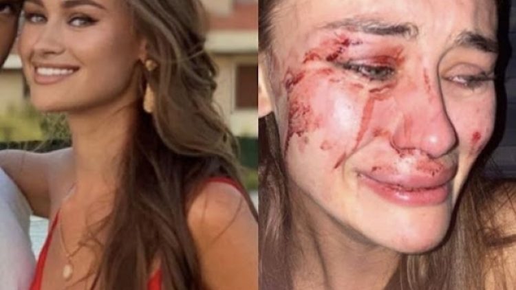 Top modelin darp olayından sonra Çeşme Kaymakamı görevden alındı