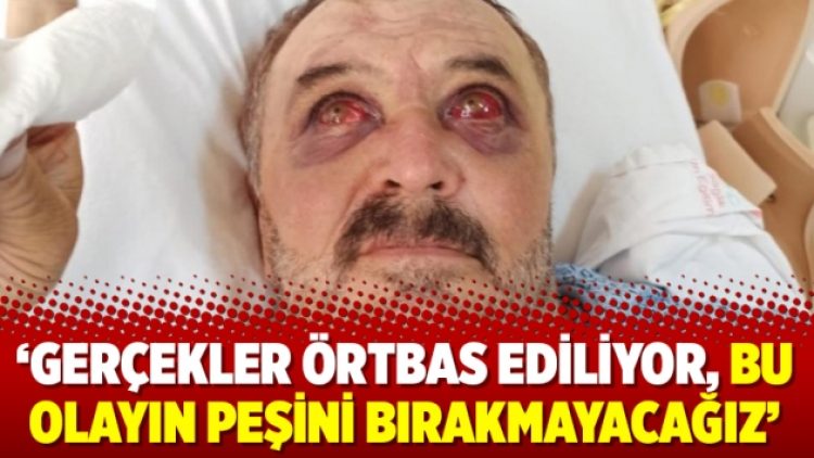 Gergerlioğlu: ‘Gerçekler örtbas ediliyor, bu olayın peşini bırakmayacağız’