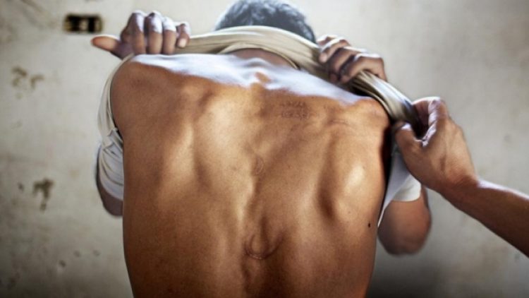 Sadece 1 ayda 5’i çocuk 255 kişi işkence gördü!