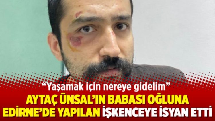 Aytaç Ünsal’ın babası oğluna Edirne’de yapılan işkenceye isyan etti: Yaşamak için nereye gidelim
