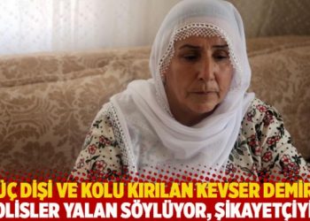 Üç dişi ve kolu kırılan Kevser Demir: Polisler yalan söylüyor, şikayetçiyim