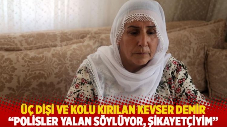 Üç dişi ve kolu kırılan Kevser Demir: Polisler yalan söylüyor, şikayetçiyim