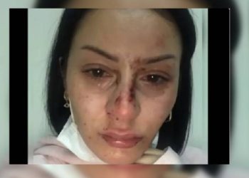 Esenyurt’ta bir kadın, 5 polis tarafından darp edildi