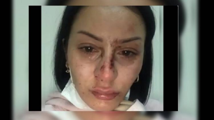 Esenyurt’ta bir kadın, 5 polis tarafından darp edildi