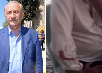 Didim Belediye Başkanı Atabay ve avukatına beyzbol sopalı saldırı