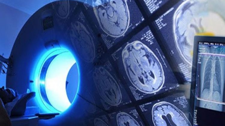 Radyoloji emekçilerinin haklarına tırpan