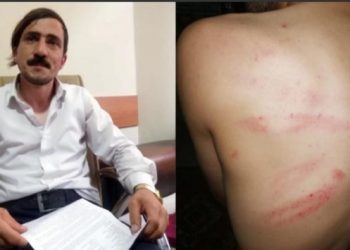 Yeniçağ muhabirinin belediye binasında dövülmesinin görüntüleri ortaya çıktı