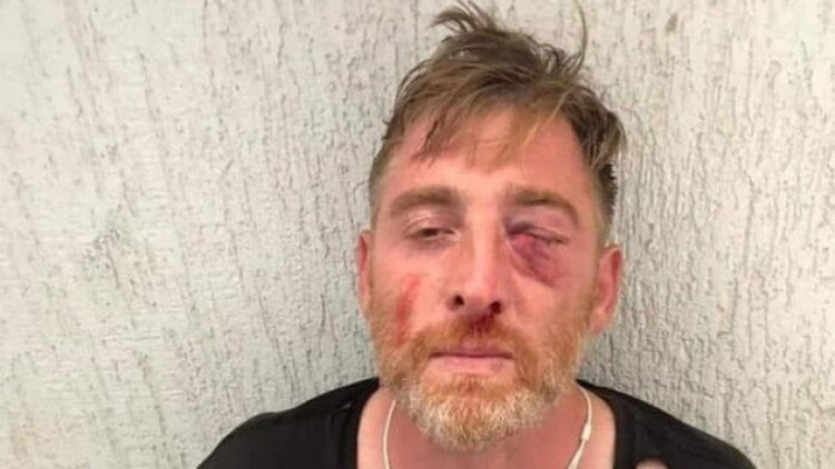 Gürcistan’da LGBTİ+ karşıtlarının yaraladığı kameraman Aleksandr Laşkarava öldü