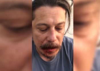 Saldırıya uğrayan gazeteci Acarer: İnfaz listeleri ciddiye alınmalı
