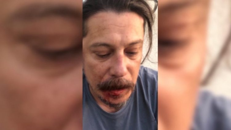 Saldırıya uğrayan gazeteci Acarer: İnfaz listeleri ciddiye alınmalı