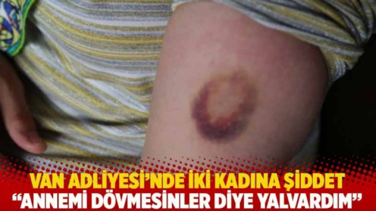 Van Adliyesi’nde iki kadına şiddet: Annemi dövmesinler diye yalvardım