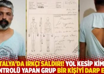 Antalya’da ırkçı saldırı! Yol kesip kimlik kontrolü yapan grup bir kişiyi darp etti