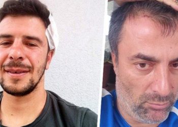 Antrenörlerin futbol sohbetinde levyeli kavga!