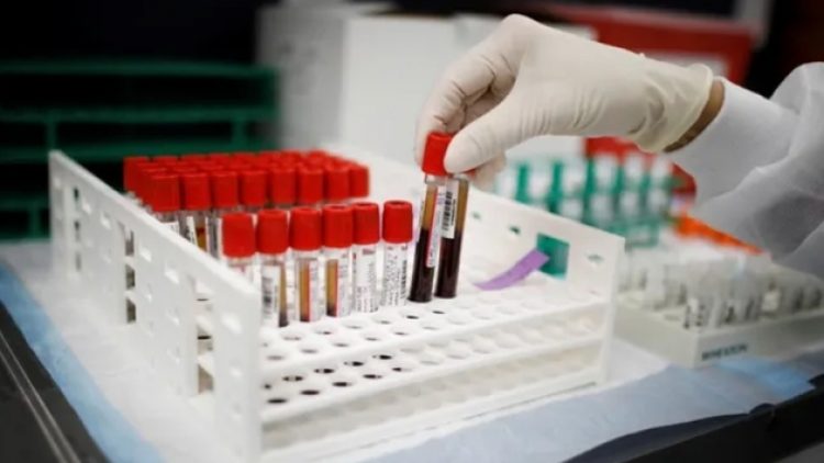 50’den fazla kanser türü için erken teşhis umudu: En geniş çaplı kan testi başlıyor