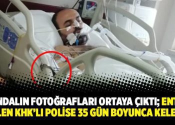 Skandalın fotoğrafları ortaya çıktı; entübe edilen KHK’lı polise 35 gün boyunca kelepçe
