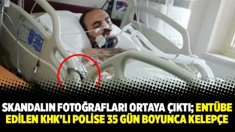 Skandalın fotoğrafları ortaya çıktı; entübe edilen KHK’lı polise 35 gün boyunca kelepçe