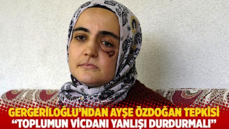 Gergeriloğlu’ndan Ayşe Özdoğan tepkisi: Toplumun vicdanı yanlışı durdurmalı