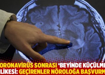 Covid sonrası ‘beyinde küçülme’ tehlikesi: Geçirenler nöroloğa başvurmalı