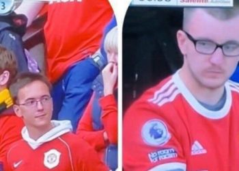 Saçları döküldüğü için tuttuğu takıma dava açıyor!