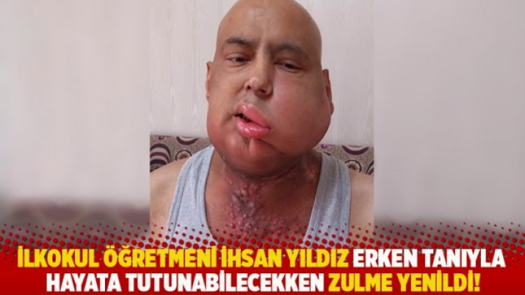 İlkokul öğretmeni İhsan Yıldız erken tanıyla hayata tutunabilecekken zulme yenildi!