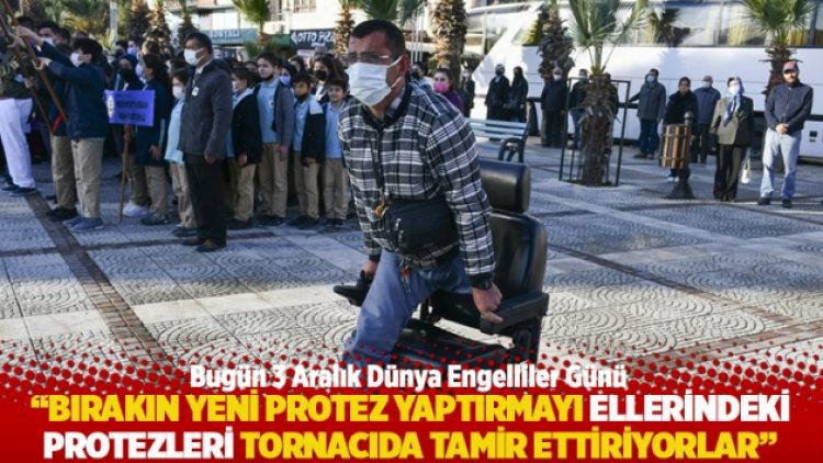 “Bırakın yeni protez yaptırmayı ellerindeki protezleri tornacıda tamir ettiriyorlar”