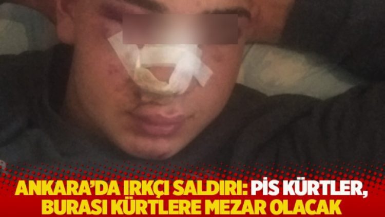 Ankara’da ırkçı saldırı: Pis Kürtler, burası Kürtlere mezar olacak