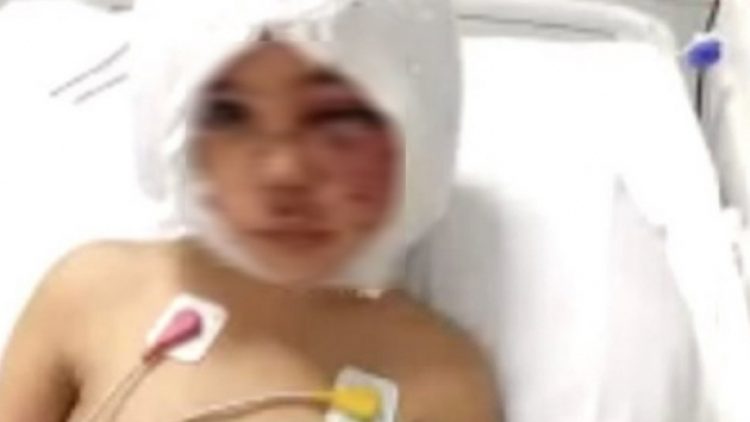 Gaziantep’te pitbull saldırısı: 6 kişiden 3’ü tutuklandı