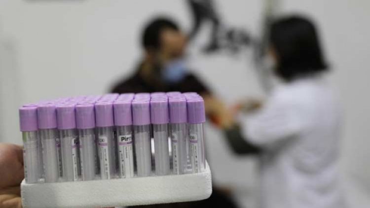 SMA taraması başladı, aile hekimlerinin iş yükü arttı