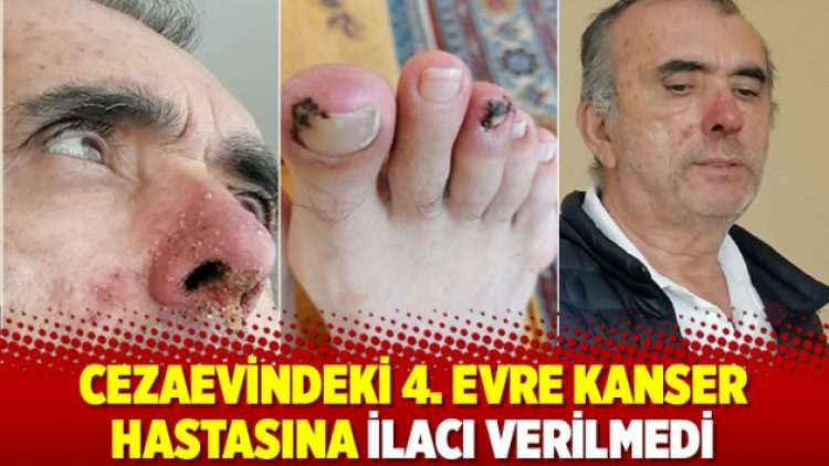 Cezaevindeki 4. evre kanser hastasına ilacı verilmedi