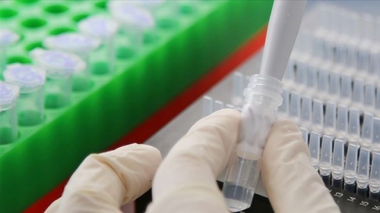 Hızla yayılan ‘gizemli’ virüs İsrail’e de sıçradı