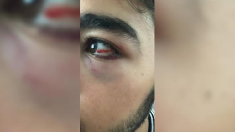 İstanbul’da 3 Arap asıllı çocuk saldırıya uğradı
