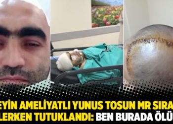 Beyin ameliyatlı Yunus Tosun MR sırası beklerken tutuklandı: Ben burada ölürüm
