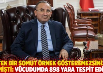 ‘Tek bir somut örnek gösteremezsiniz’ demişti: Vücudumda 898 yara tespit edildi