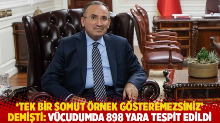 ‘Tek bir somut örnek gösteremezsiniz’ demişti: Vücudumda 898 yara tespit edildi