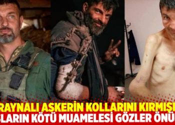 Rusların kötü muamelesi gözler önünde: Esir tuttukları Ukraynalı askerin kollarını kırmışlar