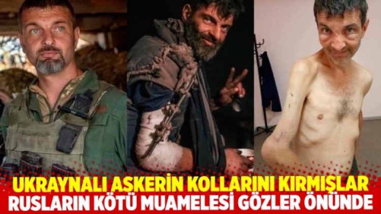 Rusların kötü muamelesi gözler önünde: Esir tuttukları Ukraynalı askerin kollarını kırmışlar